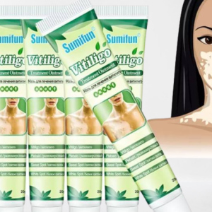 Vitiligo Cream