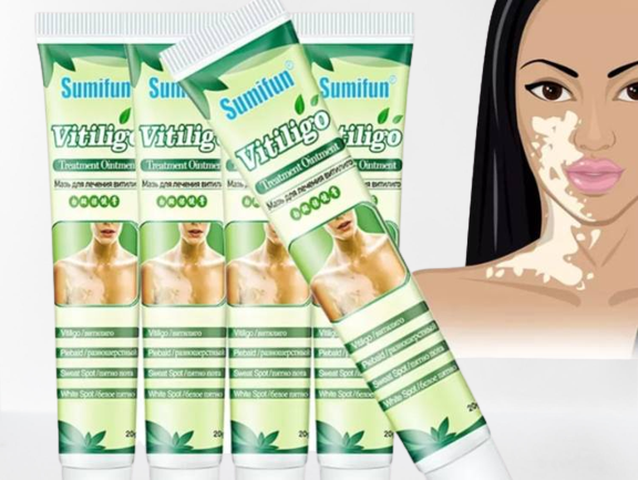 Vitiligo Cream