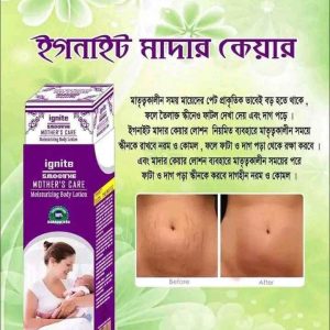 Ignite Mother Care Lotion